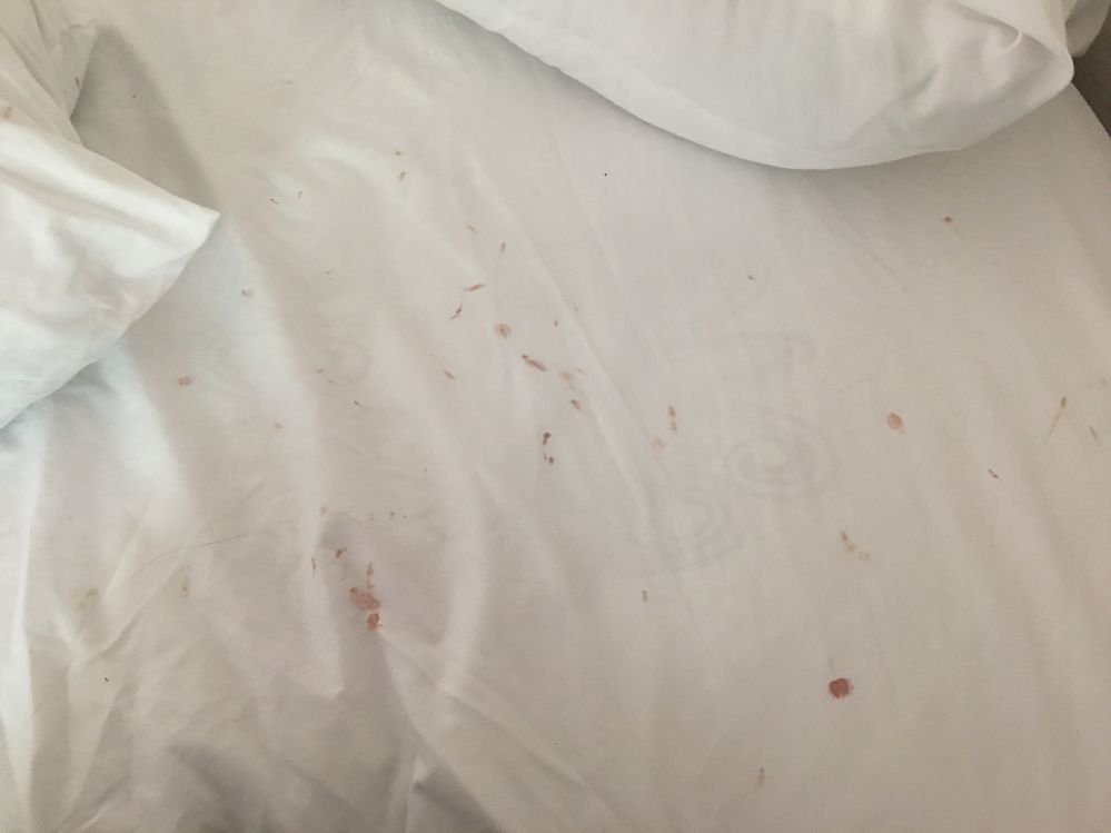 Guests said bedding had lots of blood stains, but Airbnb Community