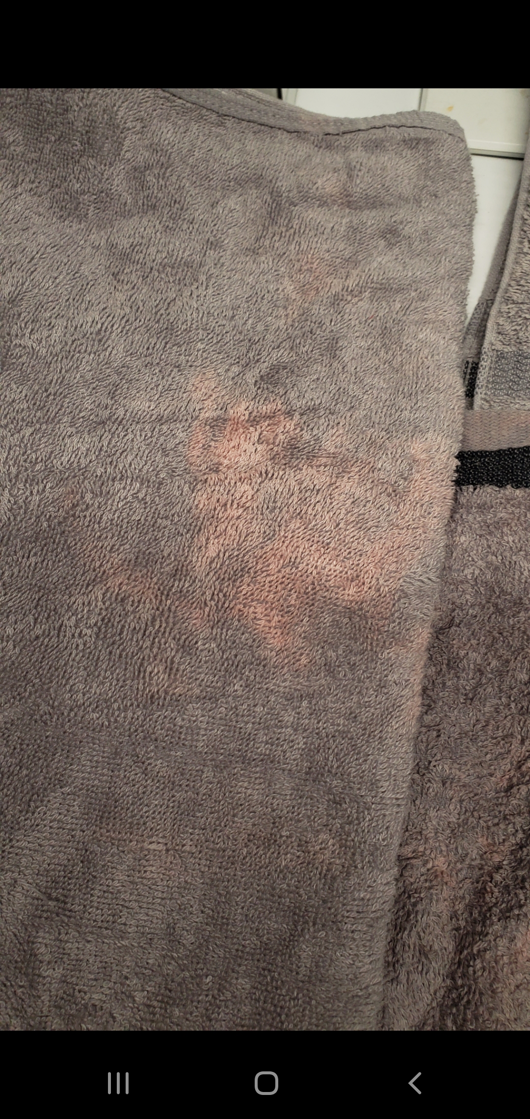 Discolored Towels and Washcloths. Airbnb Community